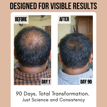 Blushlin Hair Growth Serum with Rosemary & Biotin | Strengthens Roots & Boosts Growth