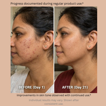 30% AHA Exfoliating Peel | 10-Minute Facial Glow | Glycolic + Lactic + Salicylic Acid + Fruit Acids | 30 ml