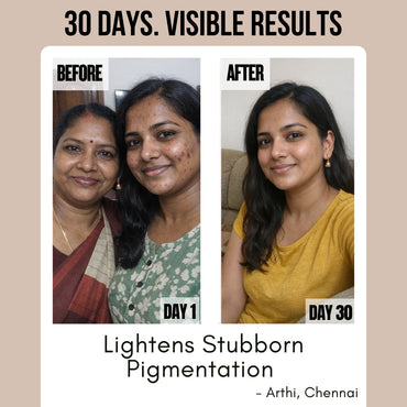 Blushlin Tranexamic acid serum for melasma, pigmentation & PIE