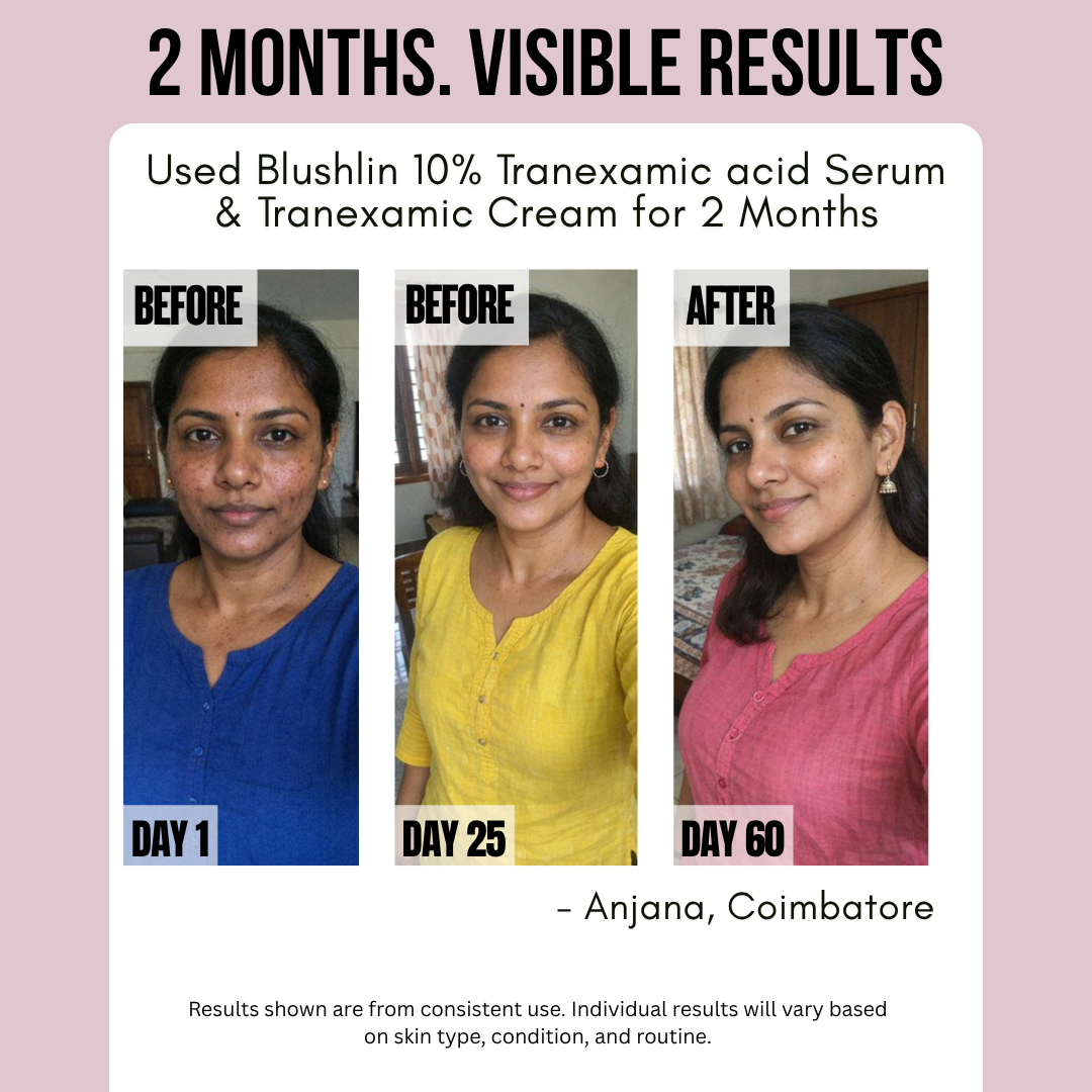 Blushlin Advanced De-Tan, Brightening & Pigmentation Repair Duo | Tranexamic Acid Serum + Brightening Cream | Fades Dark Spots & Restores Radiance