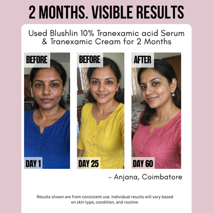 Blushlin Advanced De-Tan, Brightening & Pigmentation Repair Duo | Tranexamic Acid Serum + Brightening Cream | Fades Dark Spots & Restores Radiance