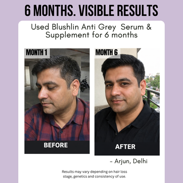 Blushlin Anti Grey Combo | 30ml Serum + 60 Capsules | Supports Natural Hair Pigmentation | Men & Women