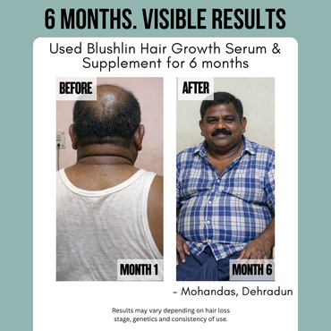 Blushlin Hair Growth Combo | 30ml Serum + 60 Capsules | Redensyl & Biotin