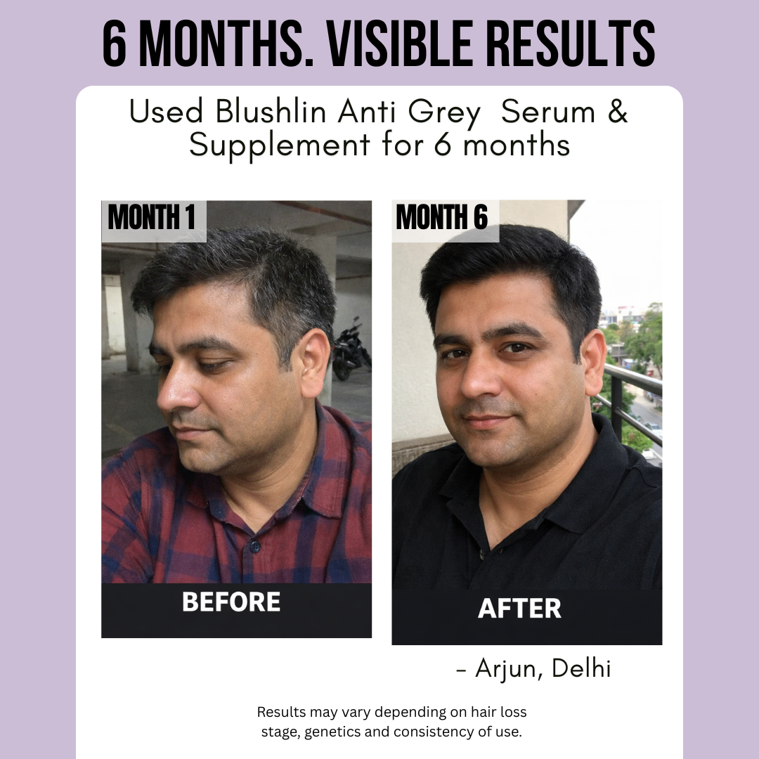 Anti-Grey Hair Supplement | Supports Natural Hair Pigmentation & Hair Color | With Copper, Catalase & L-Tyrosine | For Men & Women (60 Capsules)