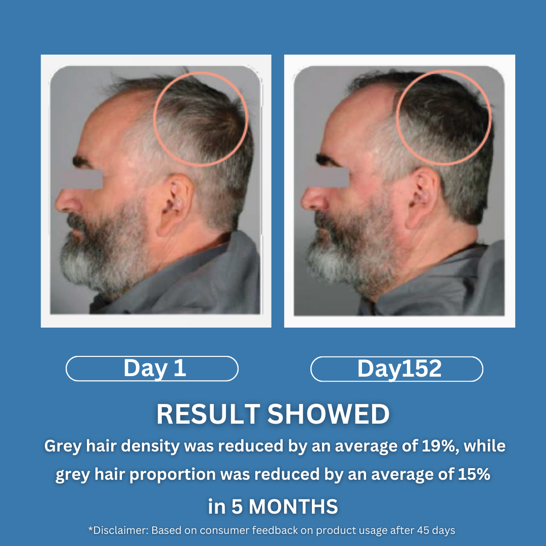 Anti grey hair serum with Arcolys® + Melanogray™ + Biotin