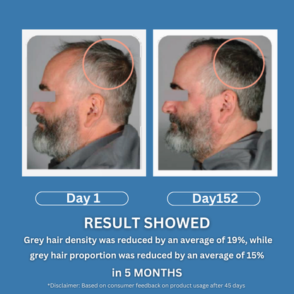 Anti grey hair serum with Arcolys® + Melanogray™ + Biotin