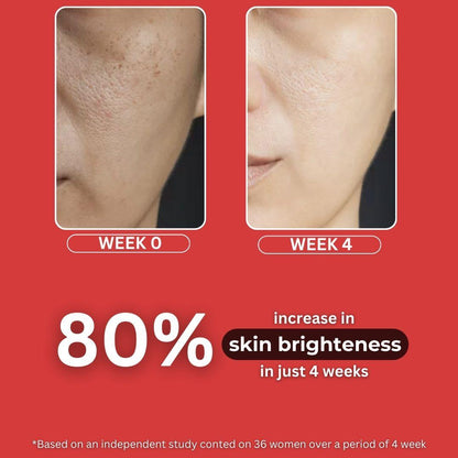 Kojic Acid Serum For Hyperpigmentation & Uneven Skin Tone