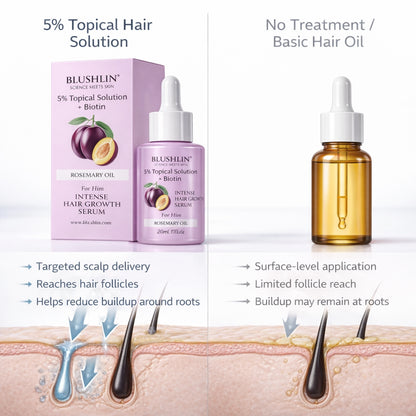 Blushlin 5% Minoxidil - Hair Growth Serum for Men | With Rosemary Oil