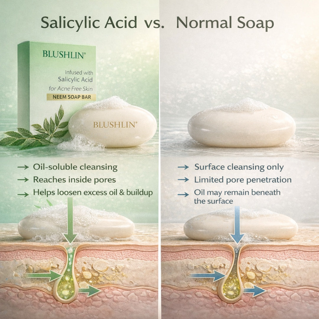 2% Salicylic Acid Soap for Oily, Acne-Prone Skin, Breakouts & Pore Cleansing - Pack of 2