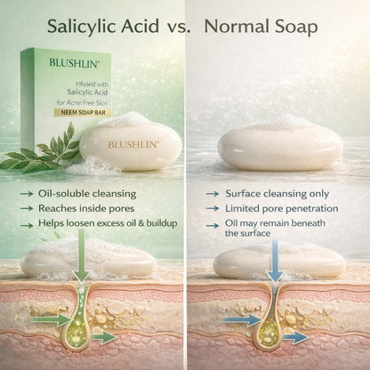 2% Salicylic Acid Soap for Oily, Acne-Prone Skin, Breakouts & Pore Cleansing - Pack of 2
