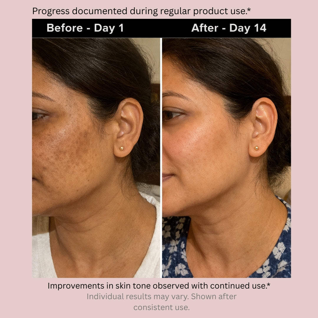 Kojic Acid Serum for Dark Spots & Brightening | Vitamin C + Niacinamide