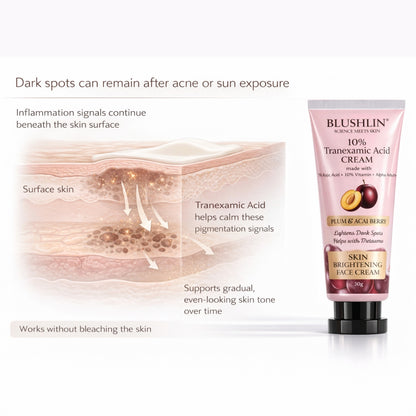10% Tranexamic Acid Cream helps Pigmentation, Even Skin Tone, Reduce Dark Spots, Blemishes and Scars - 10gm |