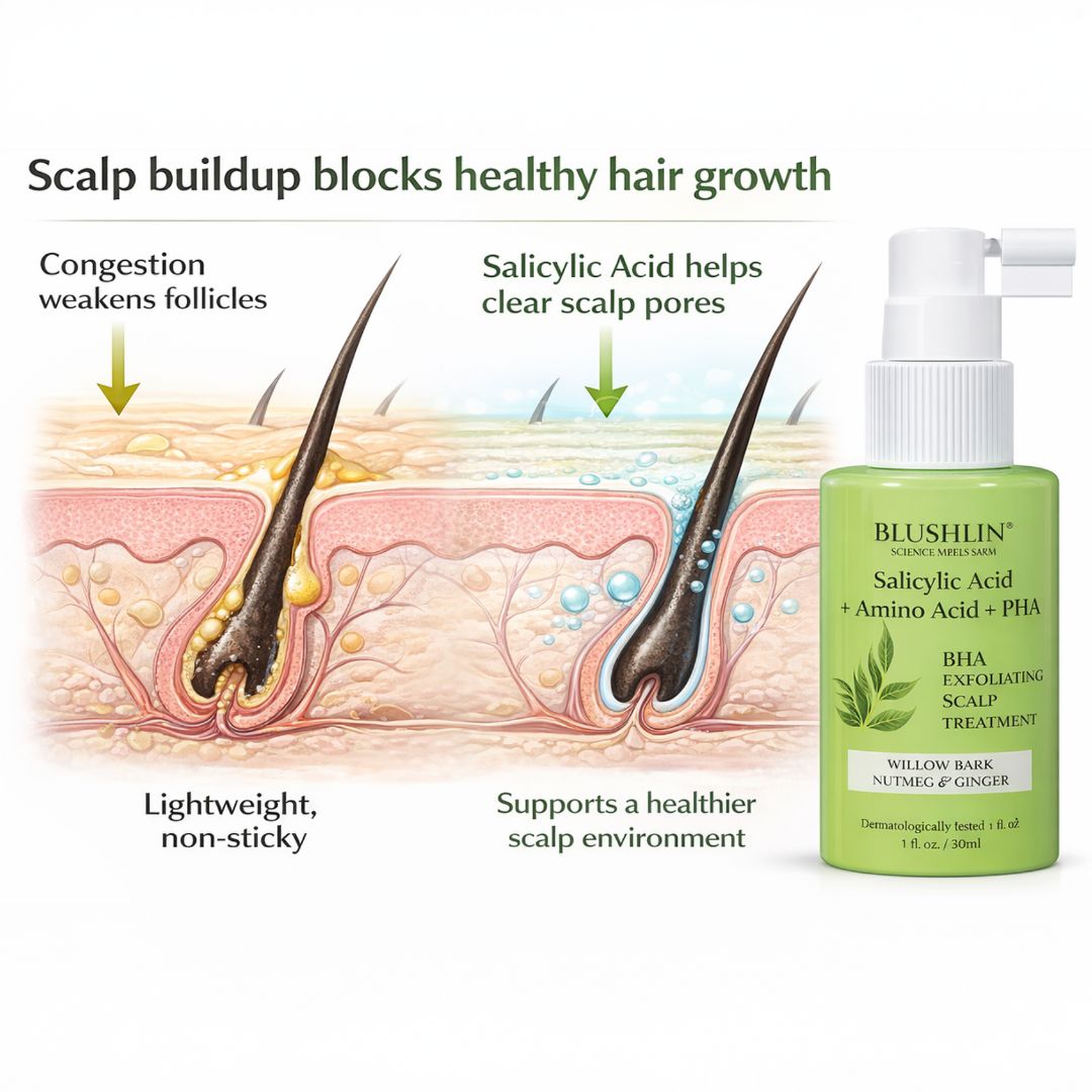 Anti-Dandruff Salicylic Acid Scalp Treatment | Clears Flakes & Scalp Buildup