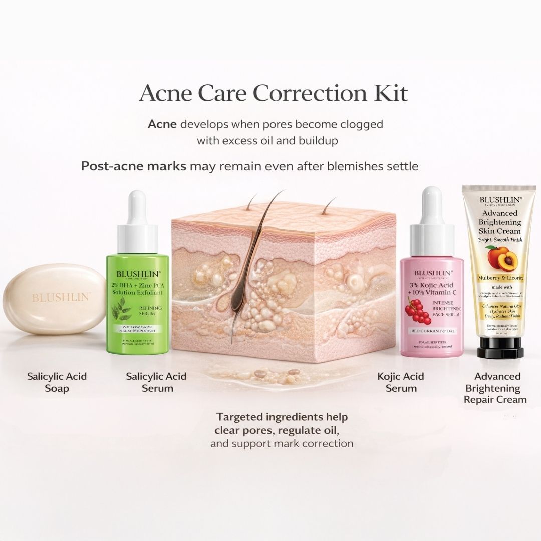 ACNE CONTROL STACK | Breakout, Oil Control & Post-Acne Mark Support | 30-Day Targeted Routine