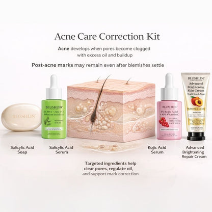 ACNE CONTROL STACK | Breakout, Oil Control & Post-Acne Mark Support | 30-Day Targeted Routine
