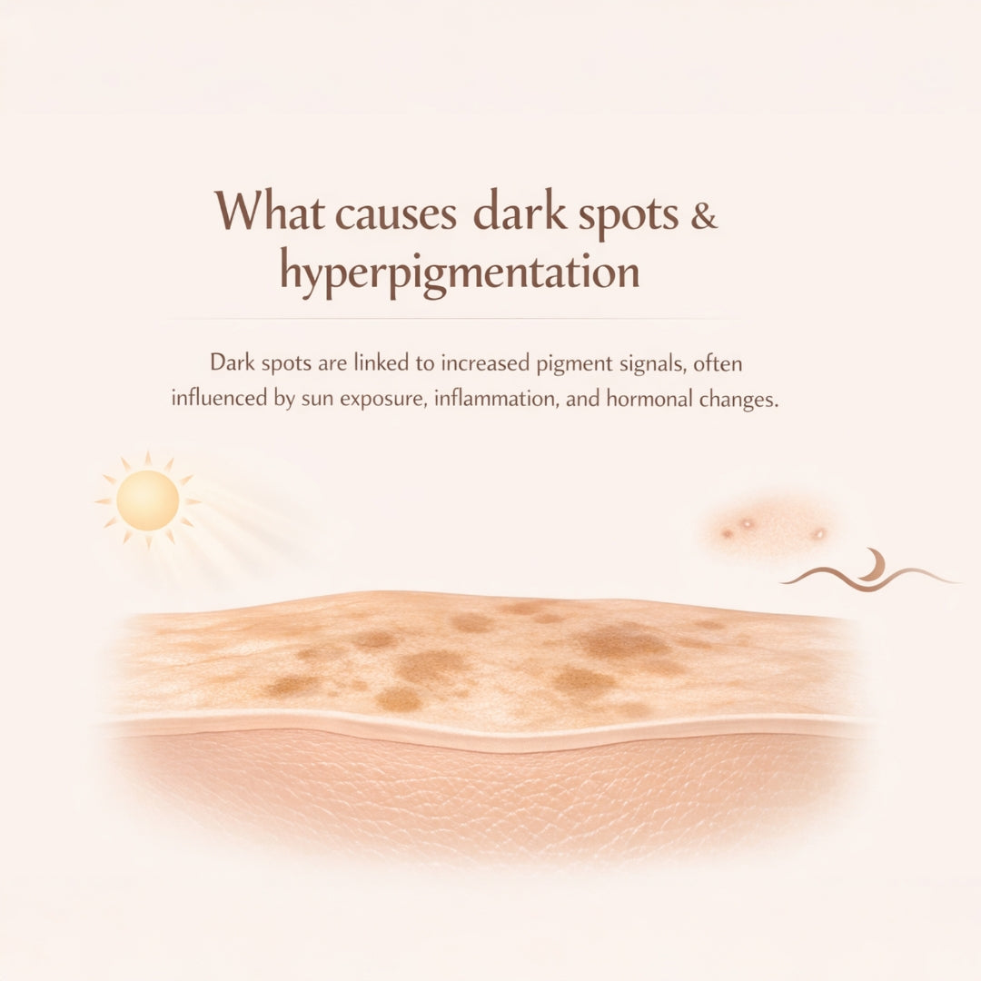 10% Tranexamic Acid Cream helps Pigmentation, Even Skin Tone, Reduce Dark Spots, Blemishes and Scars - 10gm |