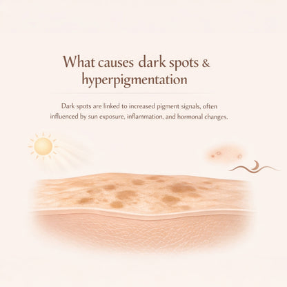 10% Tranexamic Acid Cream helps Pigmentation, Even Skin Tone, Reduce Dark Spots, Blemishes and Scars - 10gm |