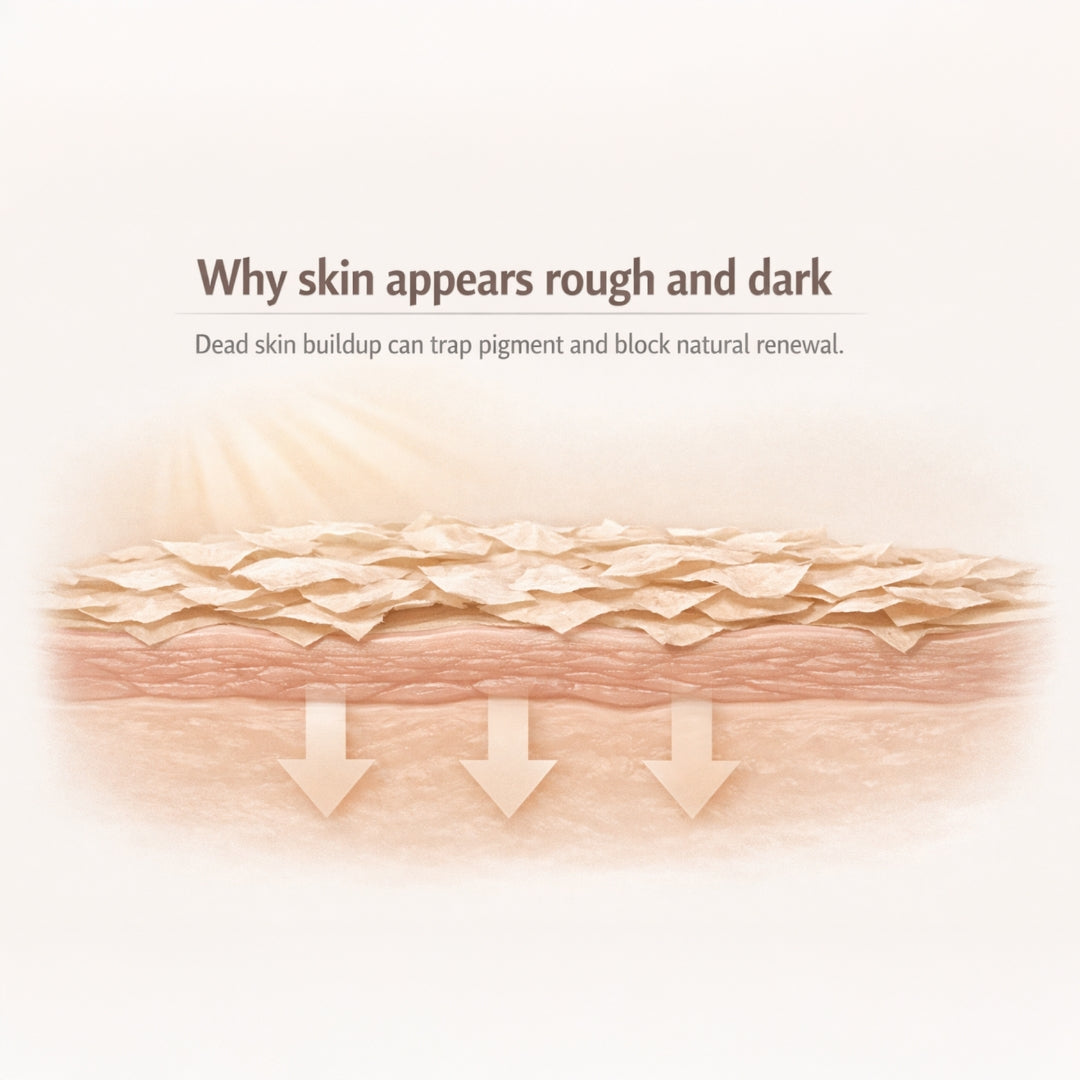 30% AHA Exfoliating Peel | 10-Minute Facial Glow | Glycolic + Lactic + Salicylic Acid + Fruit Acids | 30 ml
