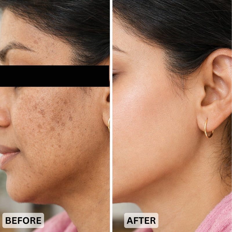 Reduced dark spots,