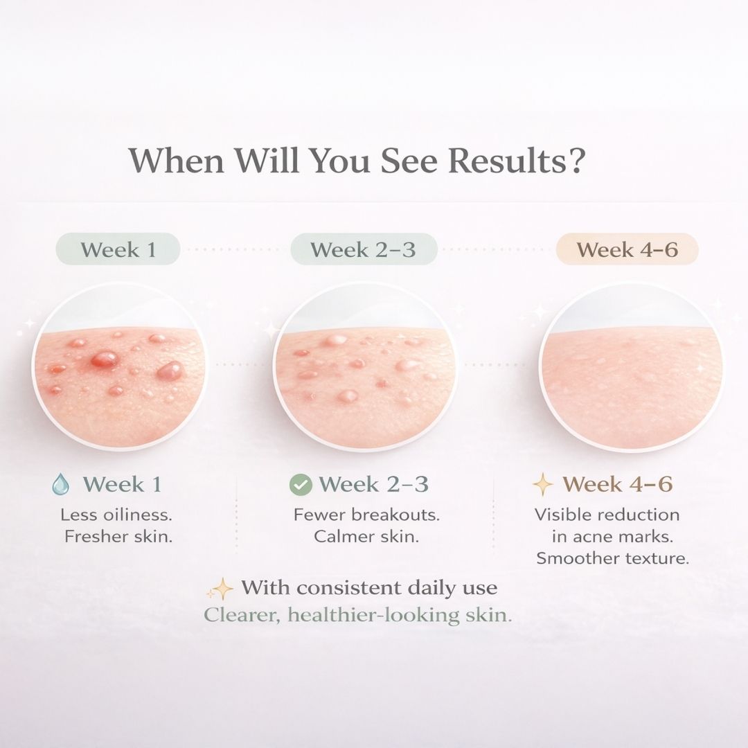 ACNE CONTROL STACK | Breakout, Oil Control & Post-Acne Mark Support | 30-Day Targeted Routine