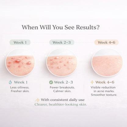 ACNE CONTROL STACK | Breakout, Oil Control & Post-Acne Mark Support | 30-Day Targeted Routine