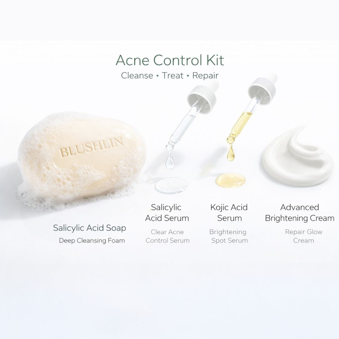 ACNE CONTROL STACK | Breakout, Oil Control & Post-Acne Mark Support | 30-Day Targeted Routine