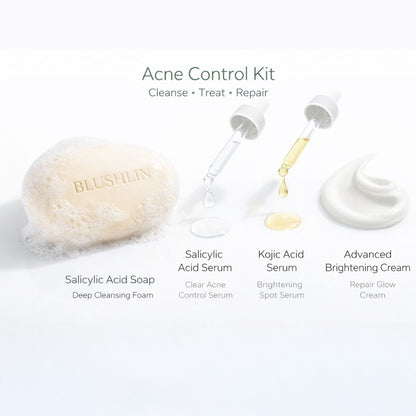 ACNE CONTROL STACK | Breakout, Oil Control & Post-Acne Mark Support | 30-Day Targeted Routine