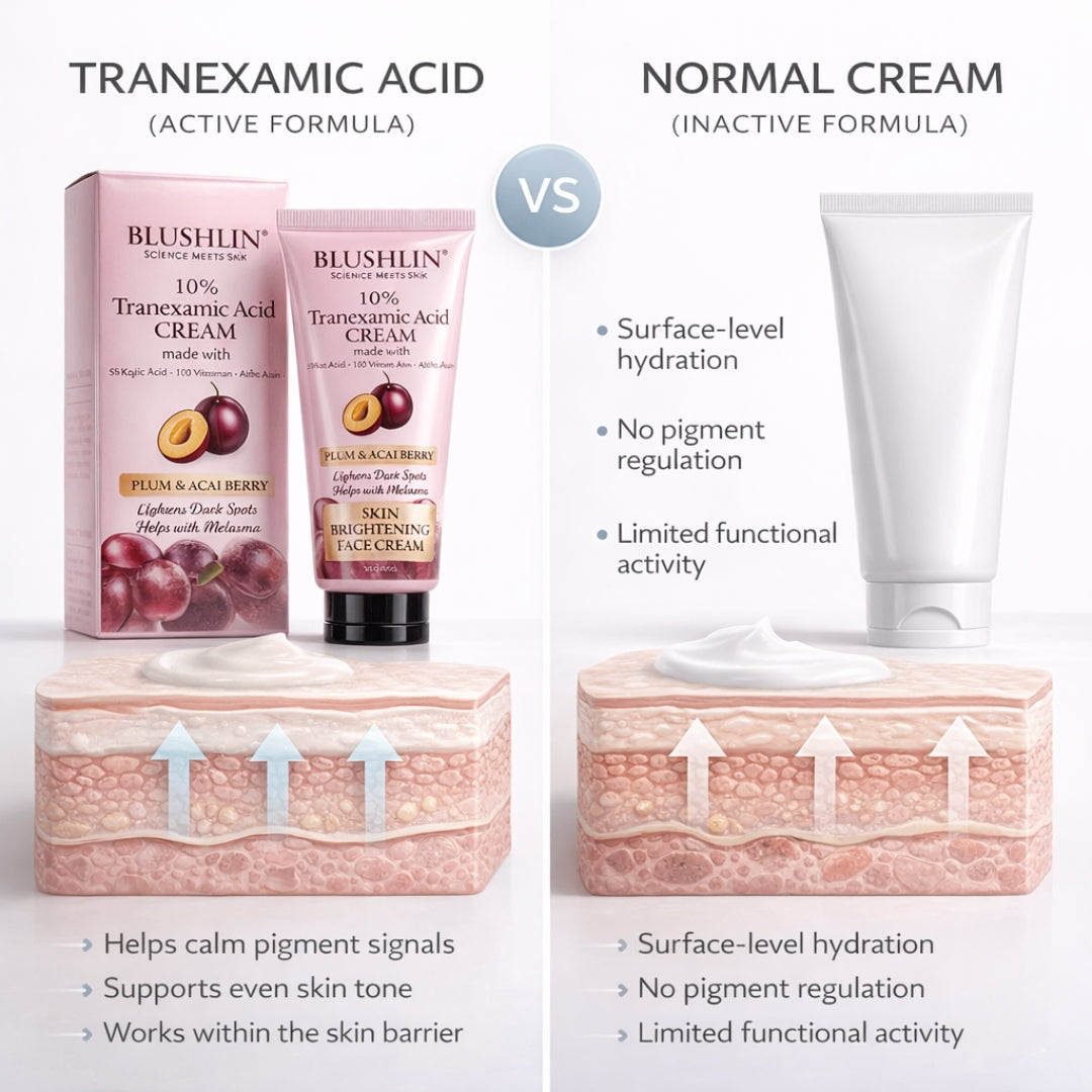 10% Tranexamic Acid Cream helps Pigmentation, Even Skin Tone, Reduce Dark Spots, Blemishes and Scars - 10gm |
